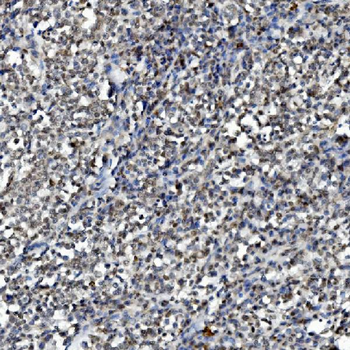 Anti-DDX1 Antibody (monoclonal, 2D4)