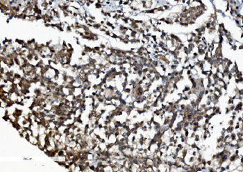 Anti-DDX1 Antibody (monoclonal, 2D4)