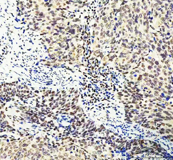 Anti-DDX1 Antibody (monoclonal, 11E5)