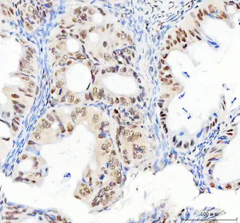 Anti-DDX1 Antibody (monoclonal, 11E5)