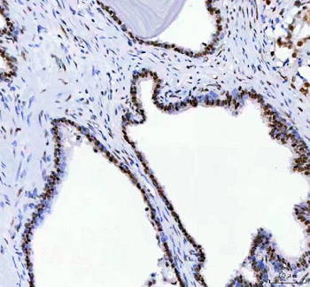 Anti-DDX1 Antibody (monoclonal, 11E5)