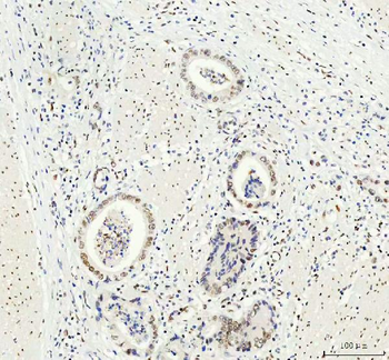 Anti-DDX1 Antibody (monoclonal, 11E5)