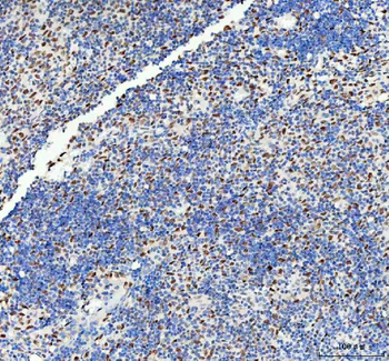 Anti-DDX1 Antibody (monoclonal, 11E5)