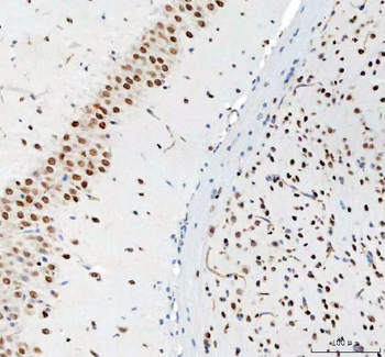 Anti-DDX1 Antibody (monoclonal, 11E5)