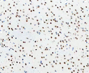 Anti-DDX1 Antibody (monoclonal, 11E5)