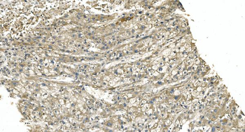 Anti-Tubulin alpha Antibody (monoclonal, 7B12)
