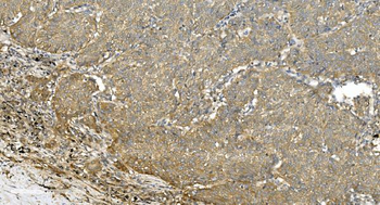 Anti-Tubulin alpha Antibody (monoclonal, 7B12)