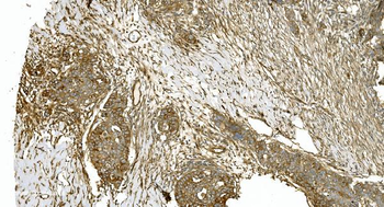 Anti-Tubulin alpha Antibody (monoclonal, 7B12)