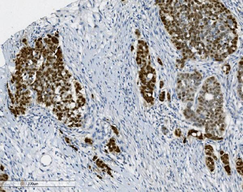 Anti-PTBP2 Antibody (monoclonal, 8F11)