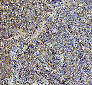 Anti-AGO3 Antibody