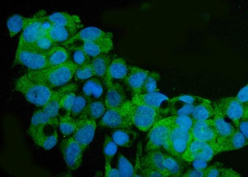 Anti-ARG2 Antibody
