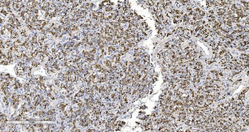 Anti-ARG2 Antibody