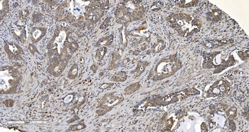 Anti-ARG2 Antibody