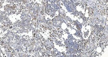 Anti-ARG2 Antibody