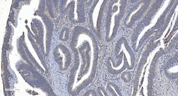 Anti-ARG2 Antibody