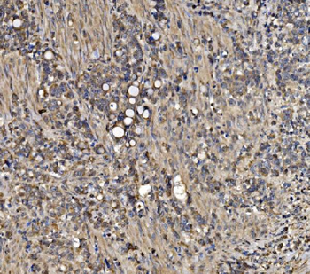 Anti-ATG9A Antibody