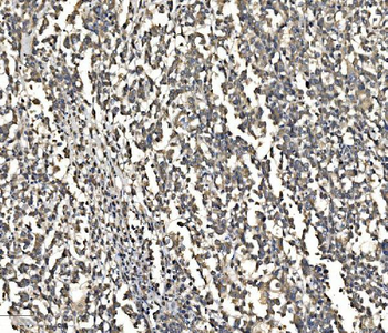 Anti-ATG9A Antibody