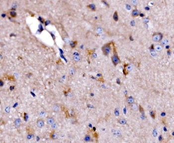 Anti-ATG9A Antibody