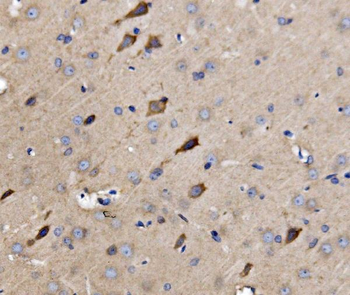 Anti-ATG9A Antibody
