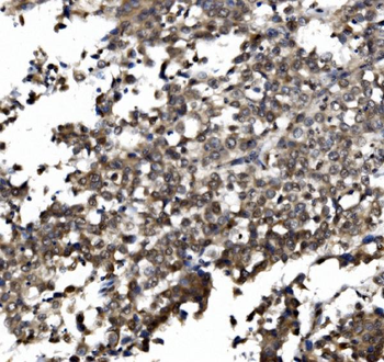 Anti-TORC1/CRTC1 Antibody