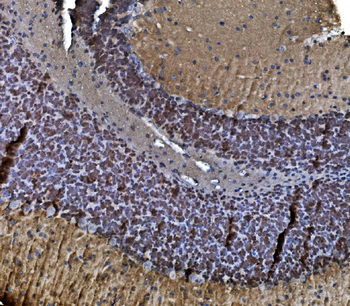 Anti-TORC1/CRTC1 Antibody