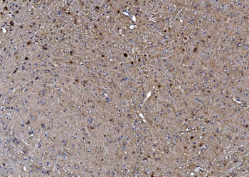 Anti-TORC1/CRTC1 Antibody
