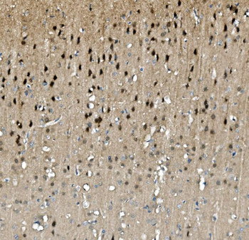 Anti-TORC1/CRTC1 Antibody