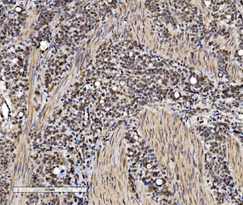 Anti-VPRBP/DCAF1 Antibody