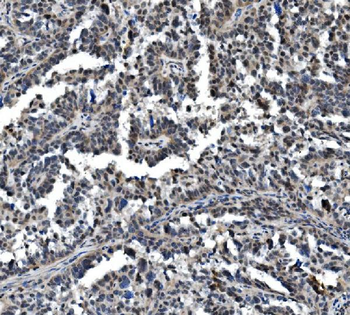 Anti-VPRBP/DCAF1 Antibody
