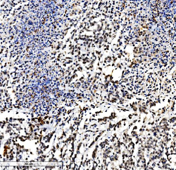 Anti-VPRBP/DCAF1 Antibody