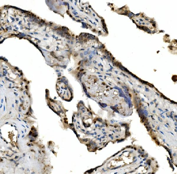 Anti-VPRBP/DCAF1 Antibody