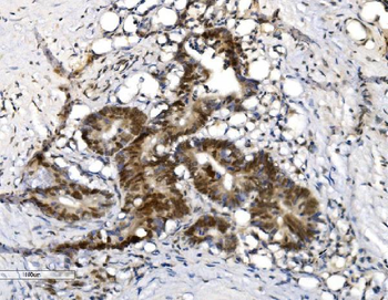 Anti-VPRBP/DCAF1 Antibody