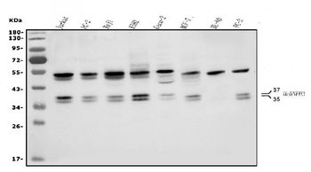 Anti-HNRNPH3 Antibody