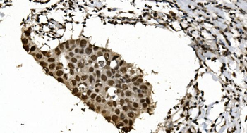 Anti-HNRNPH3 Antibody