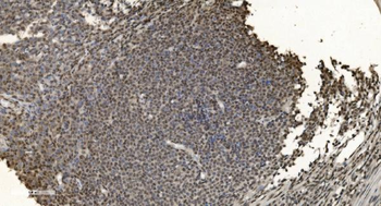 Anti-HNRNPH3 Antibody