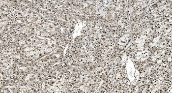 Anti-HNRNPH3 Antibody