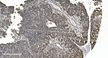 Anti-HNRNPH3 Antibody