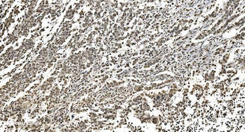 Anti-HNRNPH3 Antibody