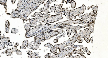 Anti-HNRNPH3 Antibody