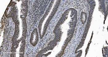 Anti-HNRNPH3 Antibody
