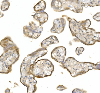 Anti-LY6E/SCA-2 Antibody