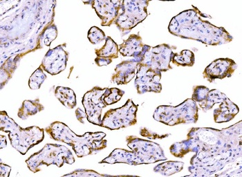 LY6E/SCA-2 Antibody