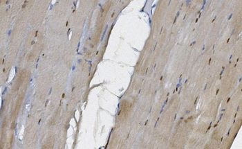 Anti-MEK5/MAP2K5 Antibody