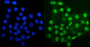 Anti-MCM4 Antibody