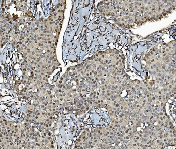 Anti-MCM4 Antibody