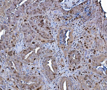 Anti-MCM4 Antibody