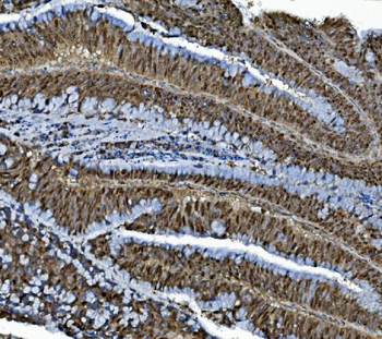 Anti-MCM4 Antibody