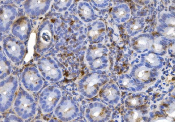 Anti-CD20/MS4A1 Antibody