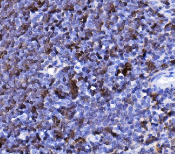 Anti-CD20/MS4A1 Antibody