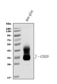 Anti-CD20/MS4A1 Antibody